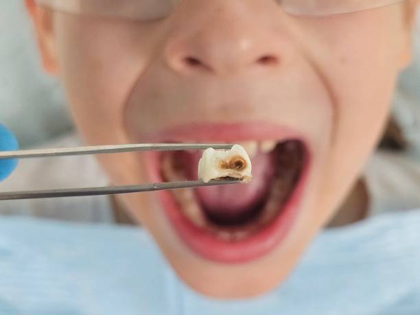 Best Mobile Emergency Dentist in Wanatah, IN