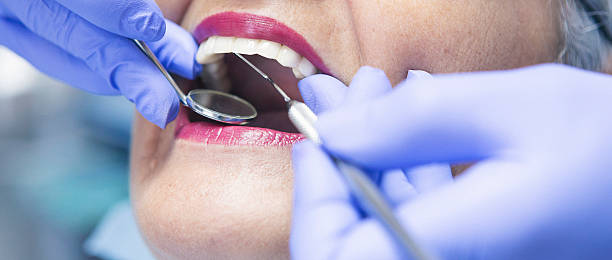 Best Emergency Dental Extractions in Wanatah, IN
